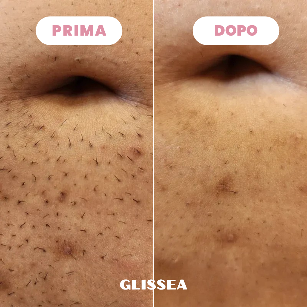 Rasoio Glissea™
