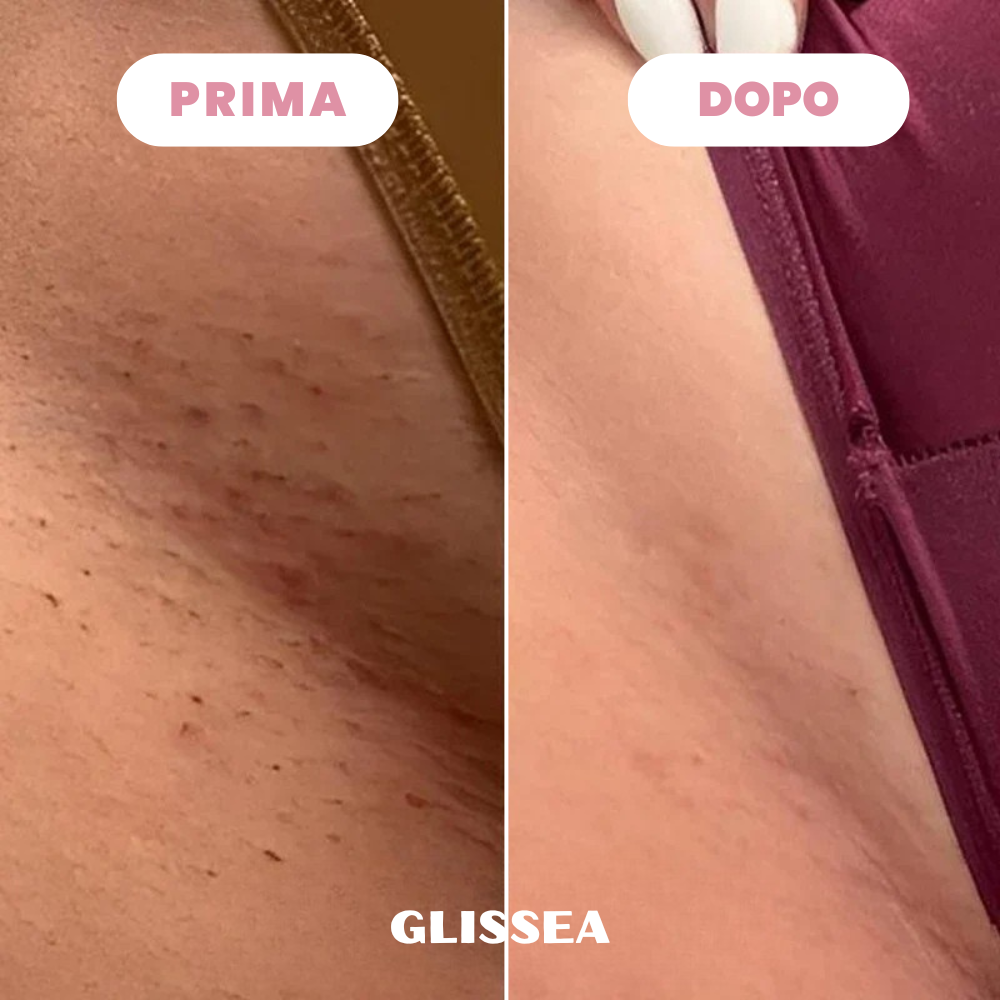 Rasoio Glissea™