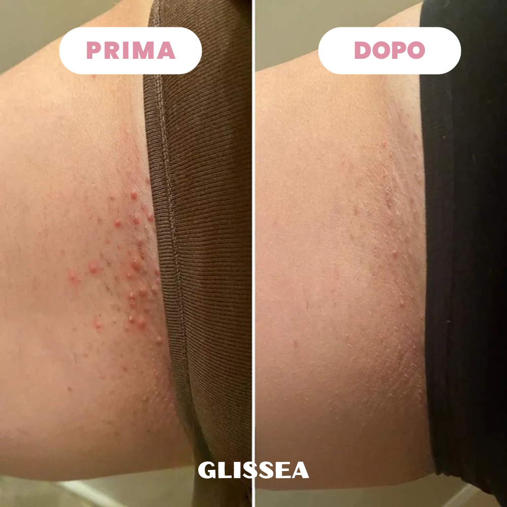 Rasoio Glissea™