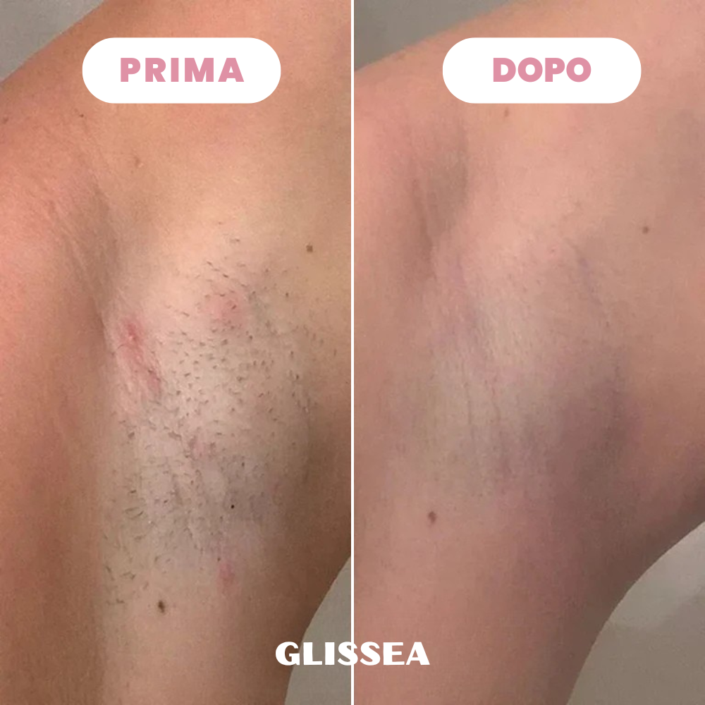 Rasoio Glissea™